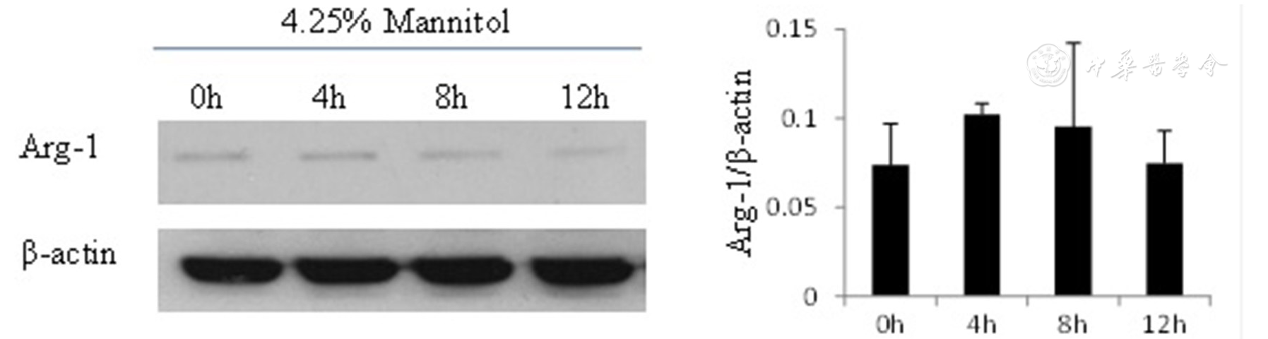 高糖环境通过激活PI3K/Akt通路诱导巨噬细胞向M2分化