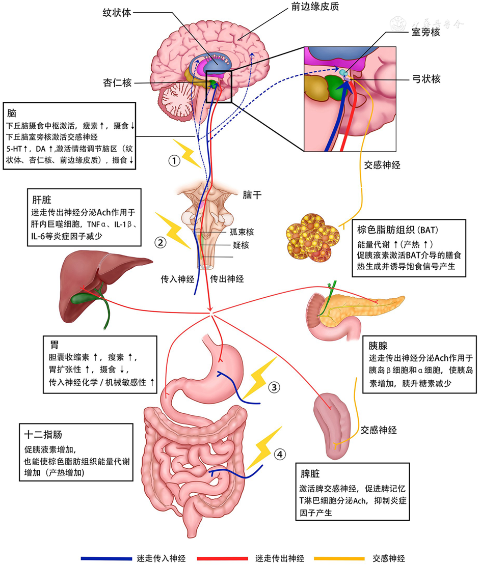 迷走神经刺激：肥胖治疗的新方法？